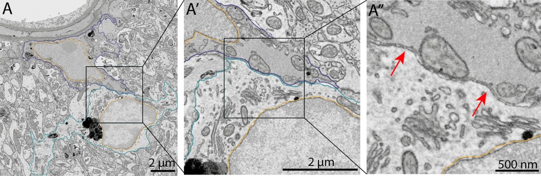 Astrocytes Alterations