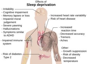 sleep disorder illustration