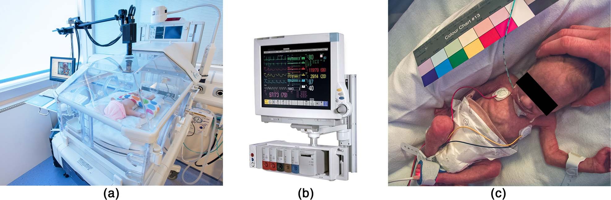 neonatal intensive care monitoring equipment