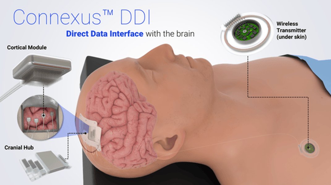 Paradromics Connexus DDI device