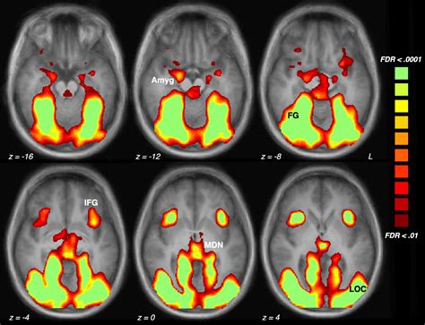 neuroimaging psychedelic brain connectivity