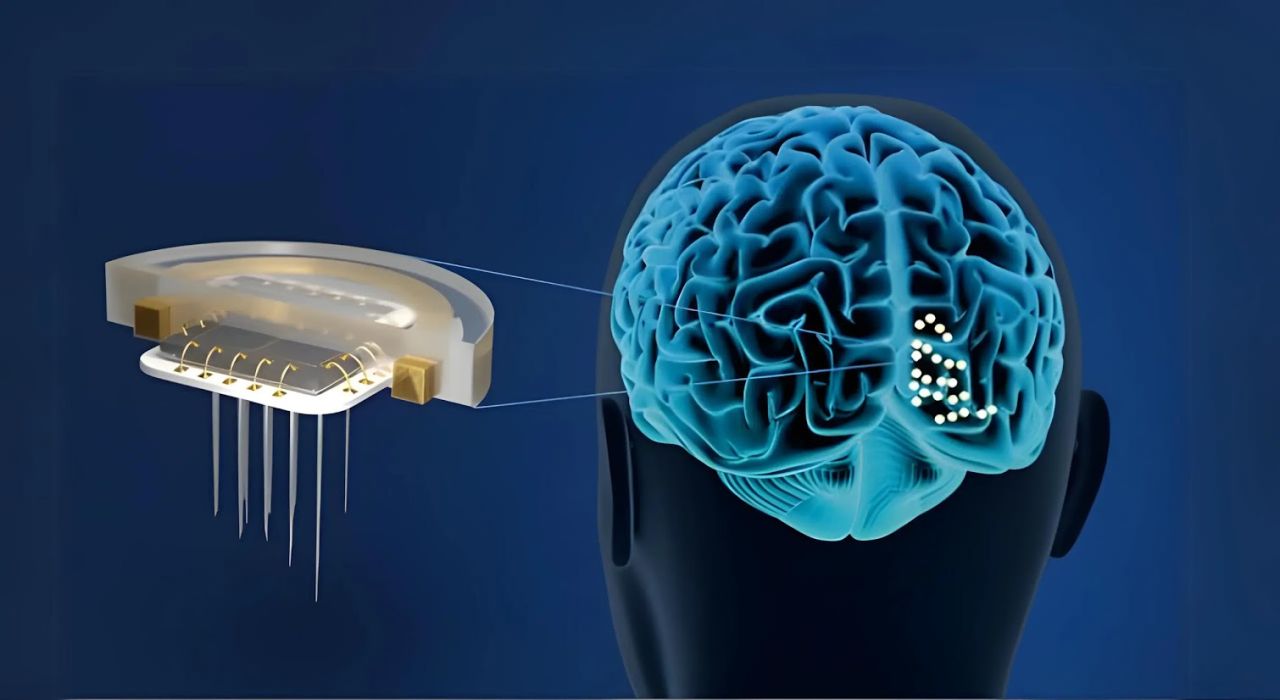 brain implants prosthesis technology