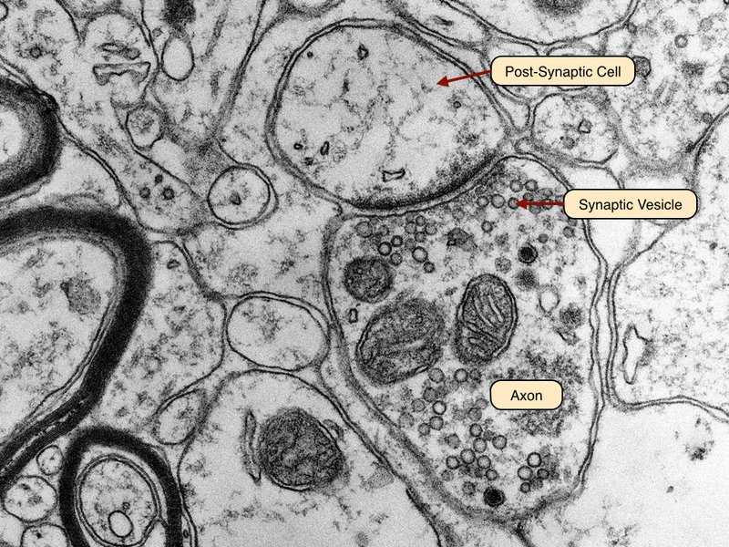 Electron micrograph showing a synapse between two neurons, highlighting the synaptic cleft and vesicles.