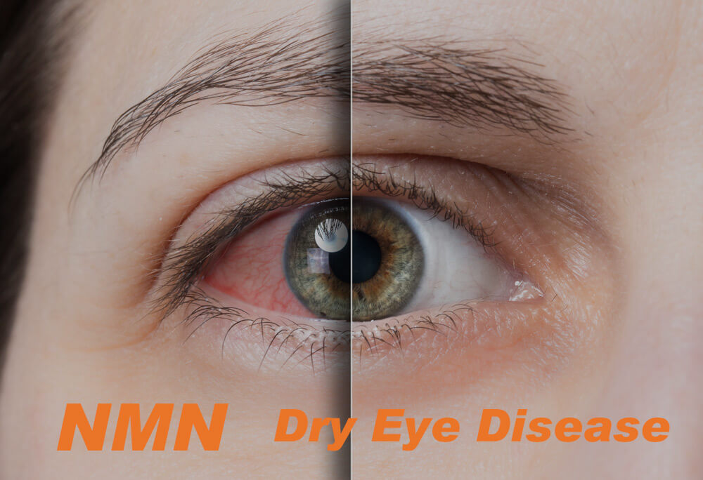 dry eye treatment with NMN, eye drops, and laboratory equipment