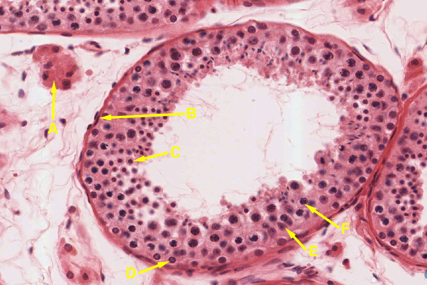 male reproductive tract microscopy