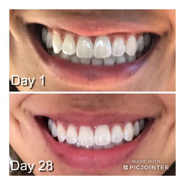 Osoba myjąca zęby po oil pulling