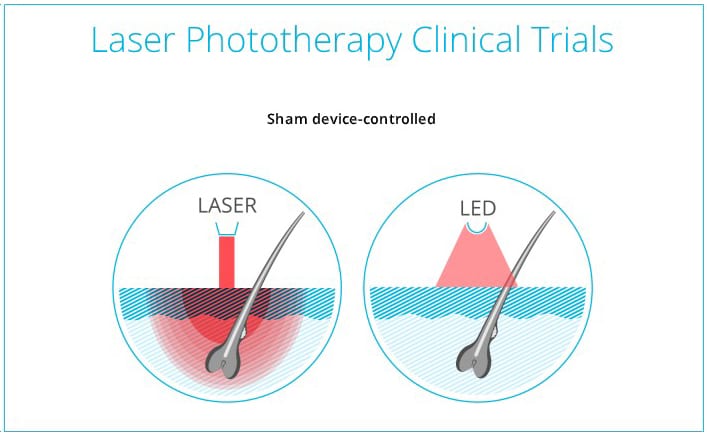 clinical trial hair regrowth equipment