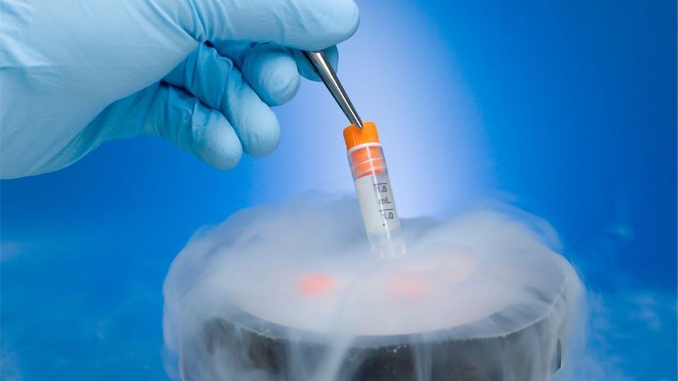 cryopreservation cells lab