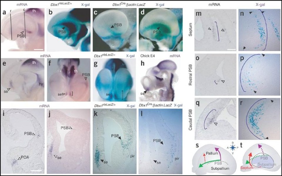 origen-celulas-cajal-retzius-472j9bx0
