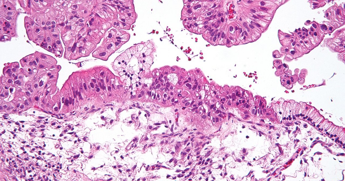 frozen sections and ovarian pathology microscope