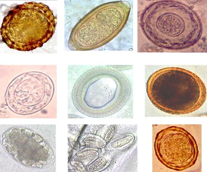 parasitologia-general-intestinal-7gsdfyf7