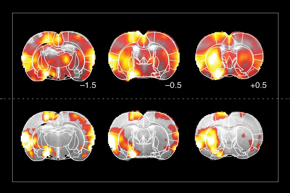 physical neurons brain scans dopamine
