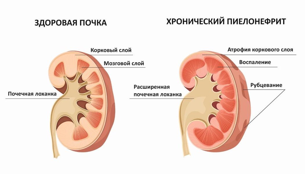 Ребенок с симптомами недомогания