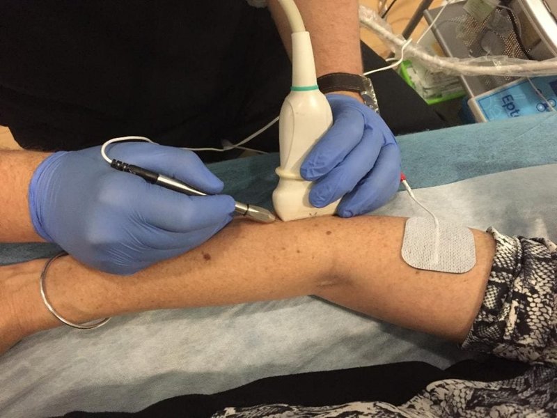 Fisioterapia para el codo