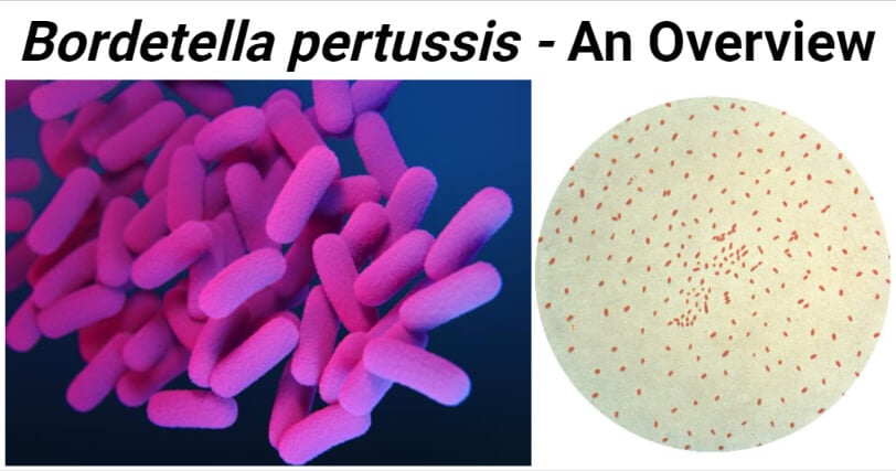 microscopic view of pertussis bacteria on agar