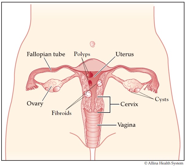 female reproductive system health clinic