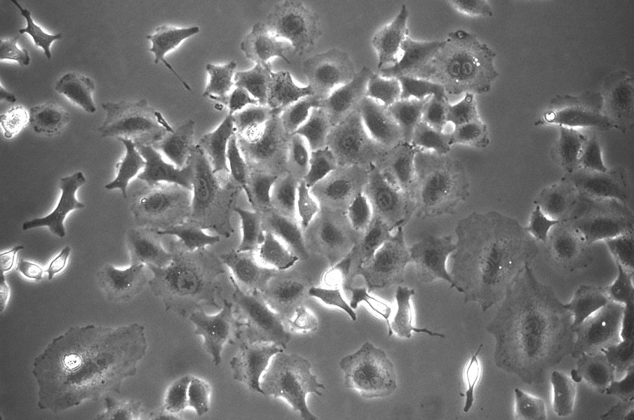 plasma-antibiotics-bacterial-infections-e2d4r6a7