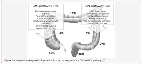 medical imaging colon cancer