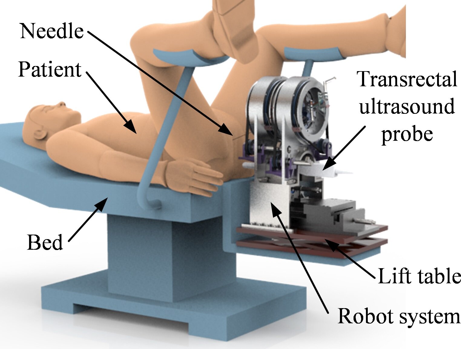 prostate scan medical equipment