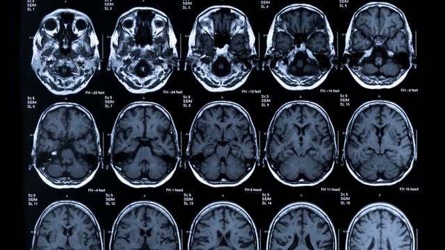 brain, psychology, neural imaging