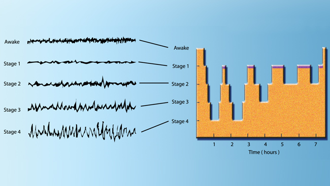 brain activity during sleep