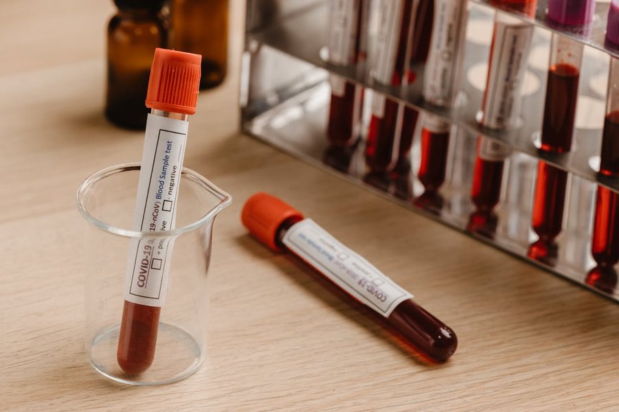 purpose-hepatitis-c-antibody-test-sgfrbhkd