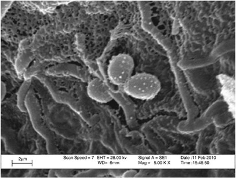 que-es-scn-microbiologia-vt4fuzan