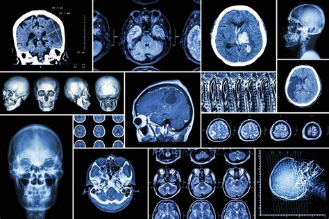 Radiology is a pivotal field in modern medicine, offering critical insights into patient diagnosis and treatment through advanced imaging techniques. To excel in this dynamic and ever-evolving domain, accessing high-quality online resources is essential for radiologists, medical students, trainees, and healthcare professionals. This comprehensive guide explores some of the best radiology websites available as of December 2024, categorized by their primary functions and utilities to help you navigate the wealth of information effectively.