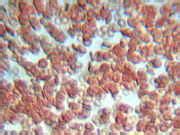 golden blood under microscope