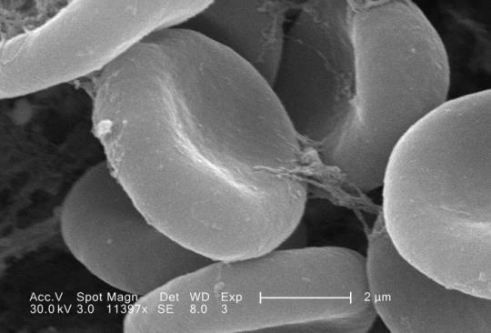 red blood cell microscope view