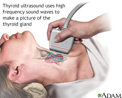 thyroid gland ultrasound medical equipment
