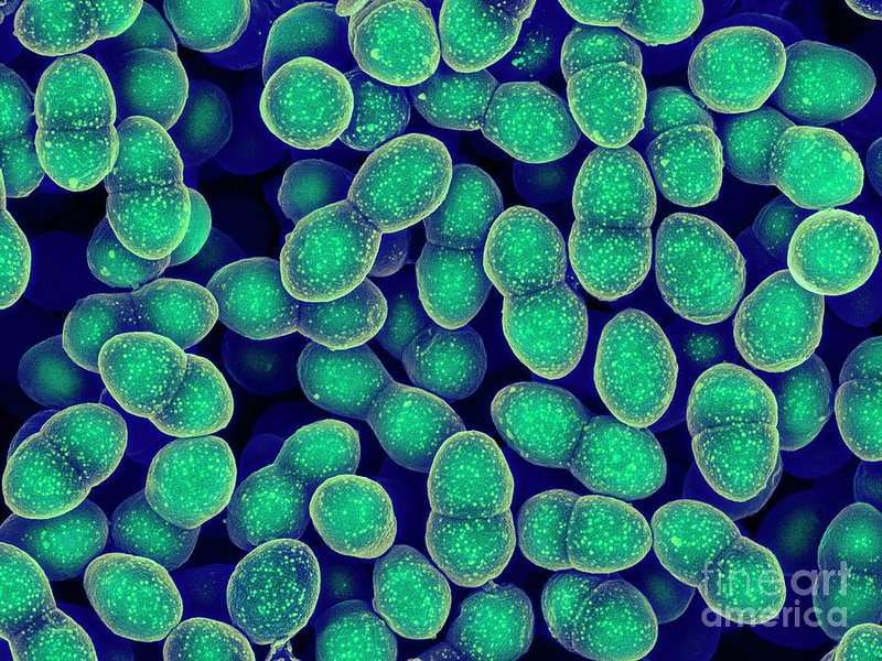 Micrografía de Enterococcus faecalis