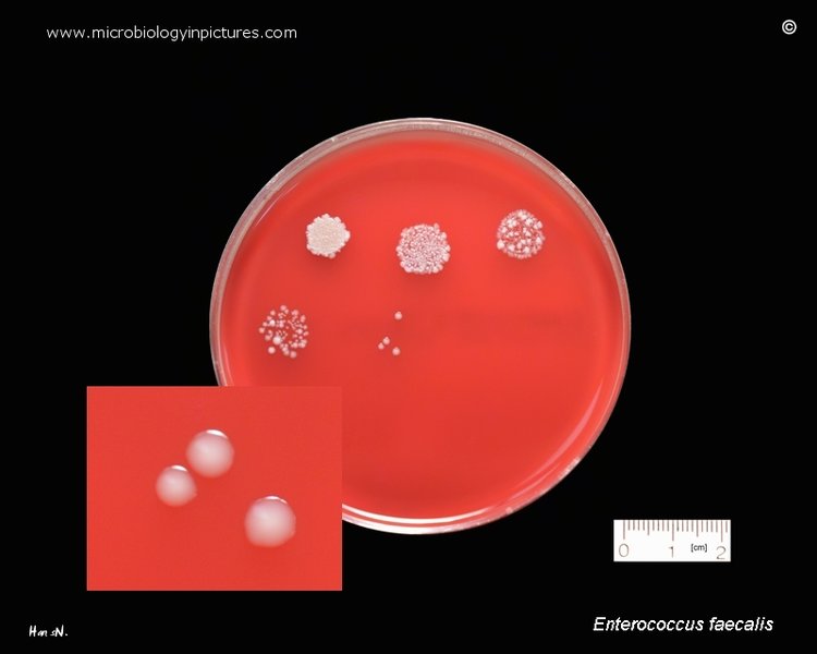 resumen-exhaustivo-enterococcus-e5680nht