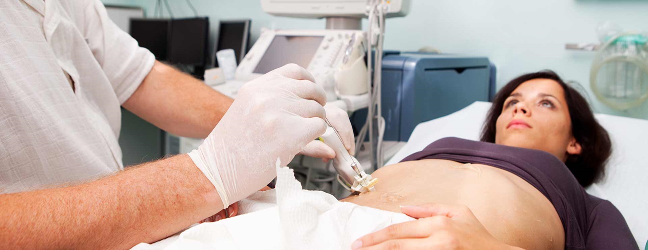 liver cirrhosis patient undergoing physical therapy