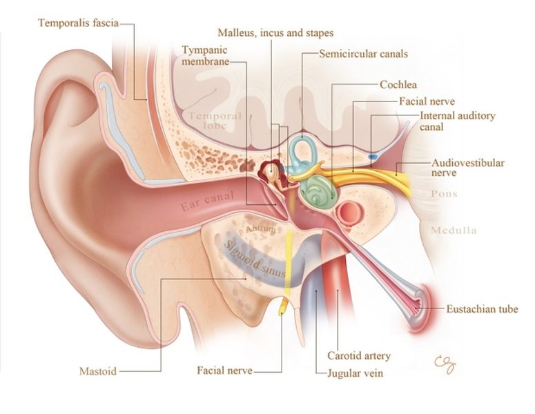 sensorineural-hearing-loss-overview-mj0e6cdj