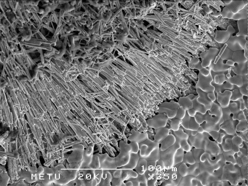 Medical Implants Made of Shape Memory Alloys