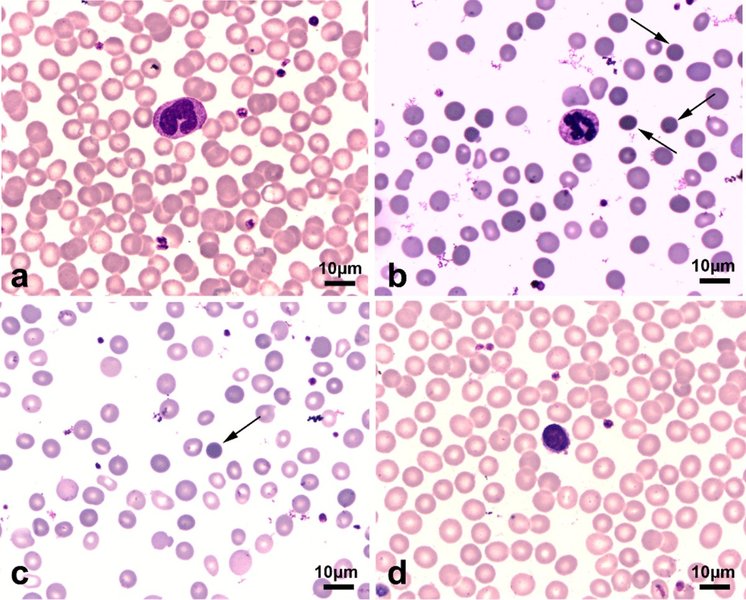 slc4a1-disk-antigen-mutation-soxrkdr8