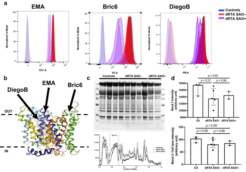 Red Blood Cell AE1/Band 3 Transports