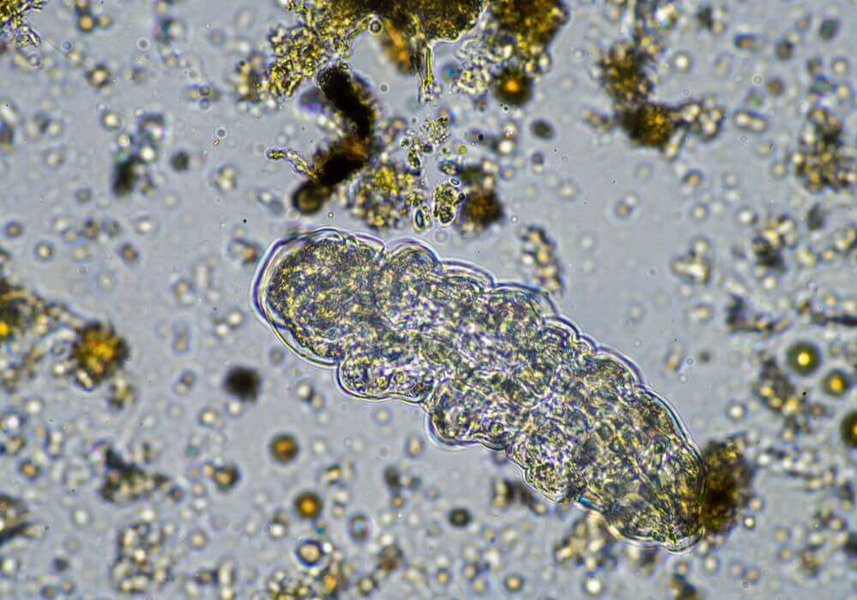 soil-microbiome-ecosystem-health-76mlc6en