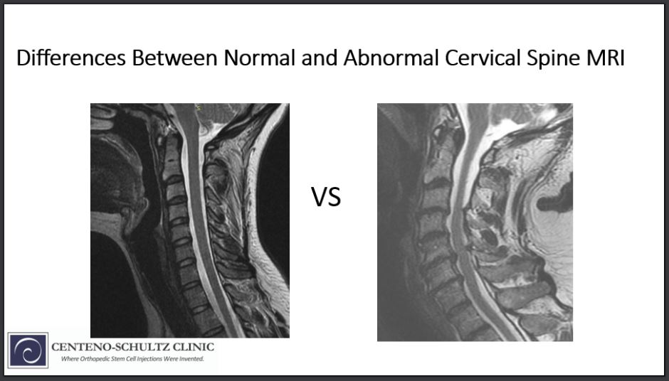 cervical spine imaging