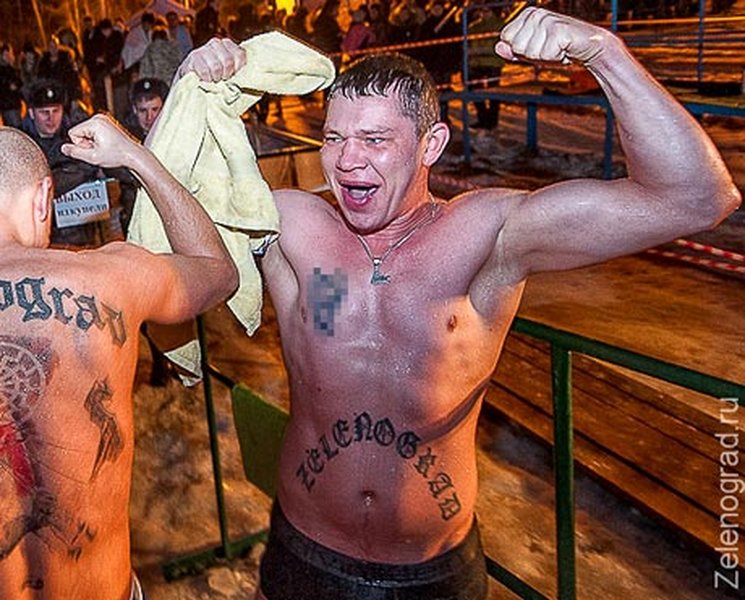 Процесс удаления татуировки лазером (современный метод)