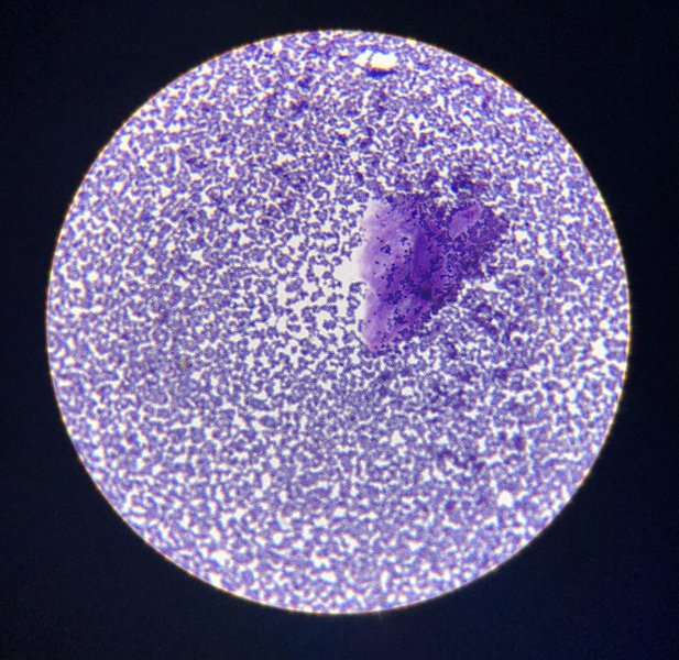 Tinción de Gram de Staphylococcus aureus