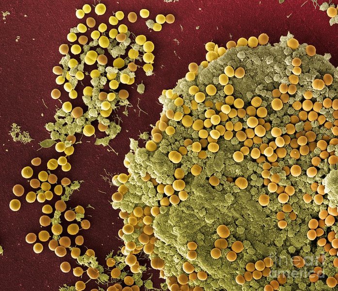 Micrografía electrónica de barrido de Staphylococcus aureus.
