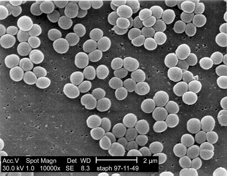 staphylococcus-cocos-grampositivos-informe-wpgc8kix