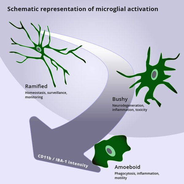 systeme-immunitaire-neurodegenerescence-l71dkv4m