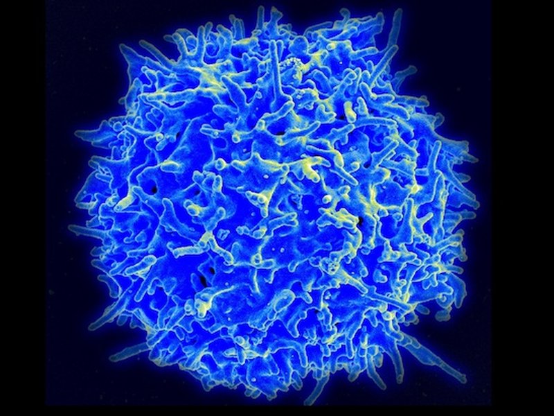 t-cell-spelling-explained-twa47145
