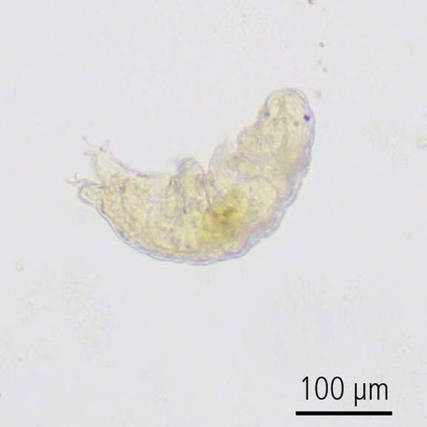 Tardigrade observed under brightfield microscopy