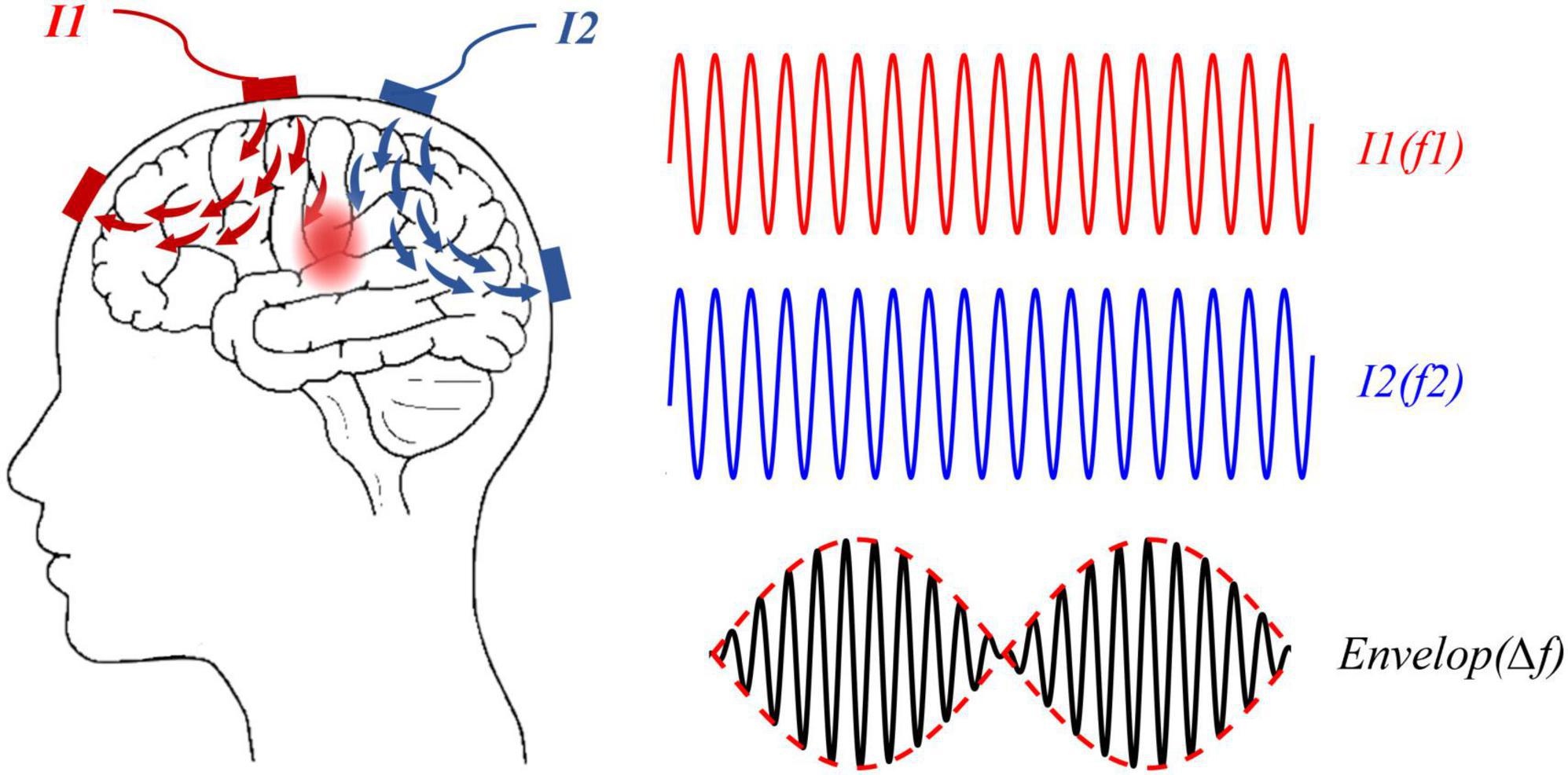 temporal interference stimulation apparatus deep brain neural circuits
