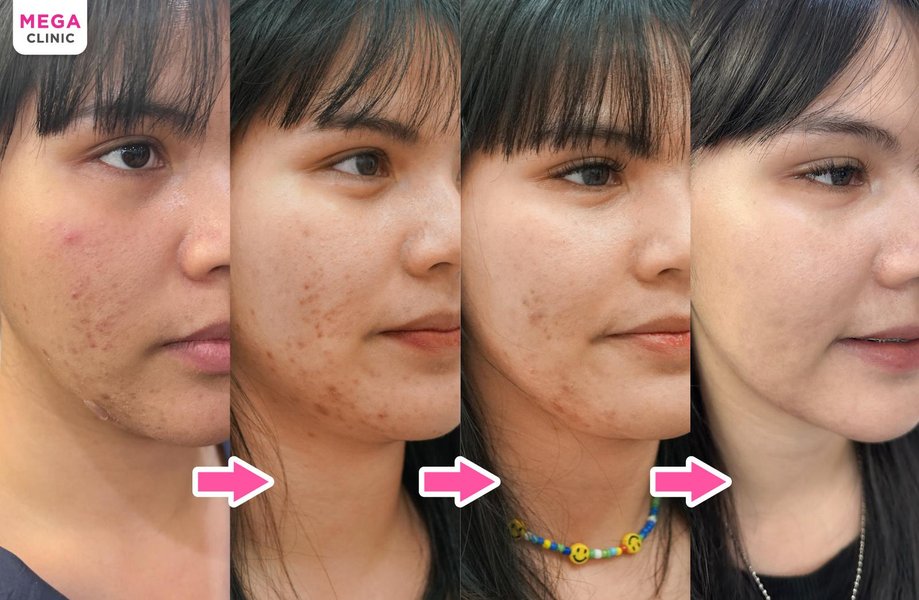 thai-skin-whitening-guide-m1e74730