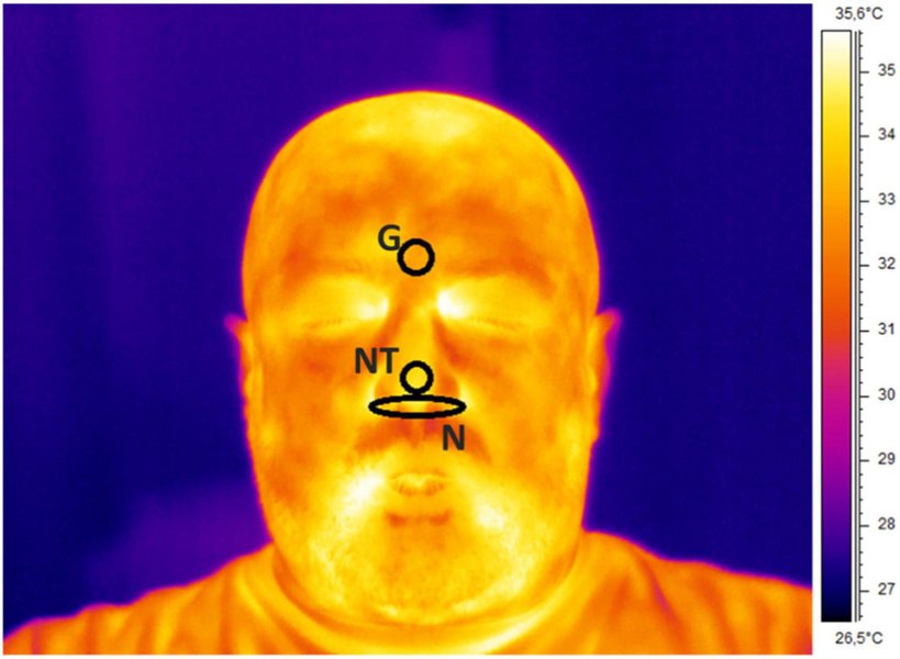 thermal-camera-heart-rate-estimation-pgjcdx4d